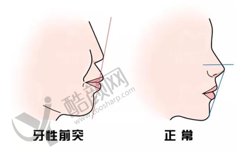 价格及选择建议