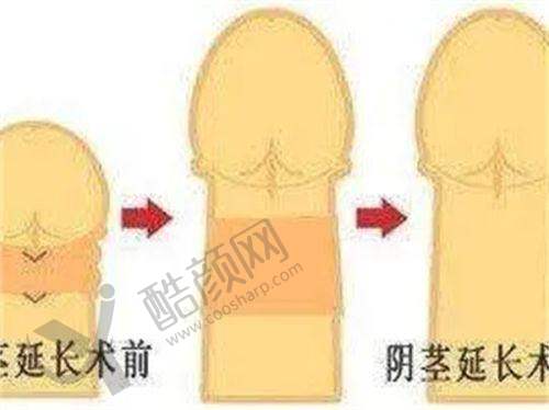 缔莱美整形医院的丰富项目