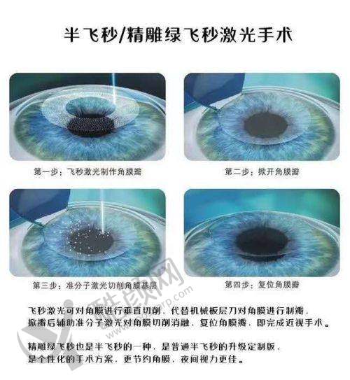 青岛泽嘉眼科医院可以用医保吗？答案是肯定的，可享一站式眼部健康管理服务