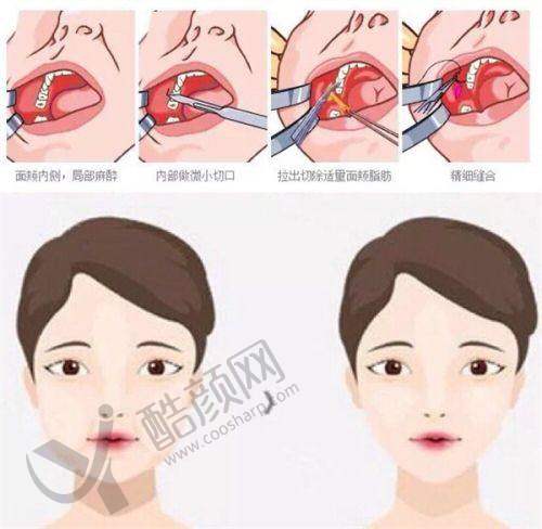 青岛诺德医学美容万连壮医生