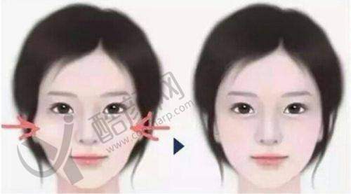 哈尔滨211美容科鼻部整形项目特色