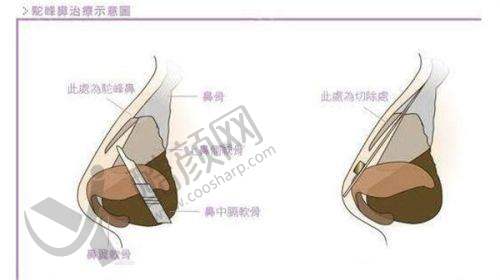 三、昆明韩辰医疗美容医院医生介绍: