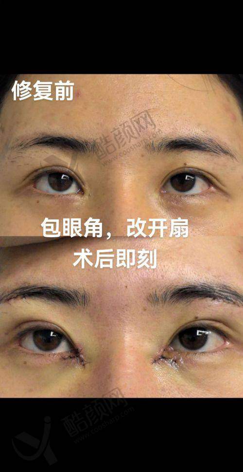 上海华美陈小剑医生的真实的患者评价如下：