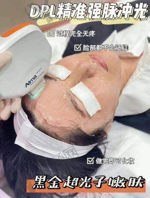 深圳美莱黄金超光子的具体优势
