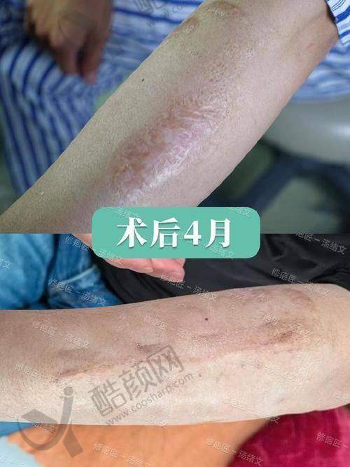 六、武汉正璞瘢痕整复医疗美容门诊部价格表：（仅供参考）