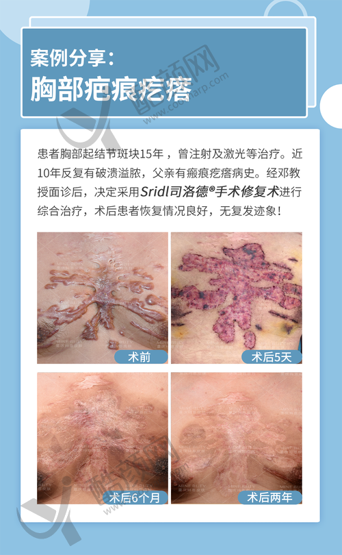 五、武汉正璞瘢痕整复医疗美容门诊部怎么预约：