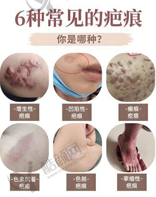 二、武汉正璞瘢痕整复医疗美容门诊部正规吗？来看看医院资质：