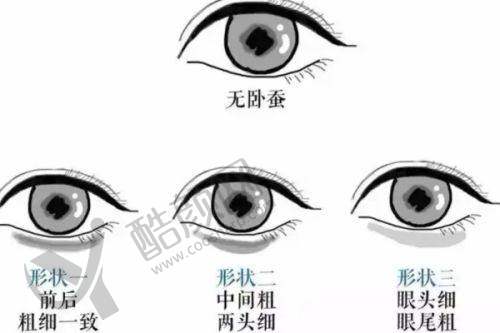 大连爱德丽格刘志刚双眼皮修复实例之烧伤患者的全眼重建