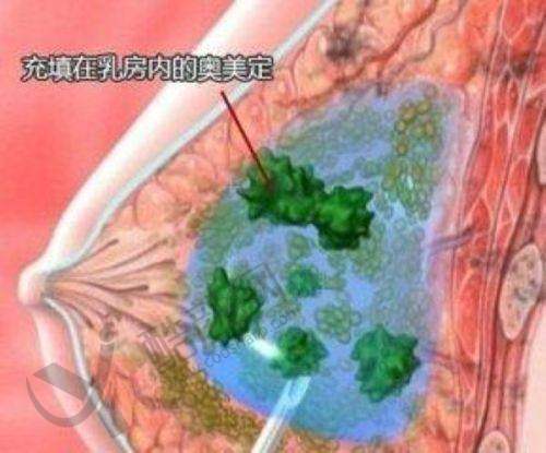 荔湾区人民医院全息清奥术优势