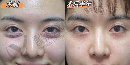 五、东莞东城紫芯医疗美容门诊部怎么预约：