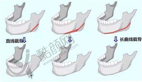 二、广州米伦医疗美容门诊部正规吗?来看看医院资质: