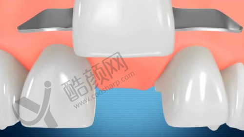 徐州牙科医院哪家好？排名前十私立口腔医院项目、价格、口碑全揭秘