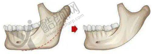 六、广州米伦医疗美容门诊部怎么预约: