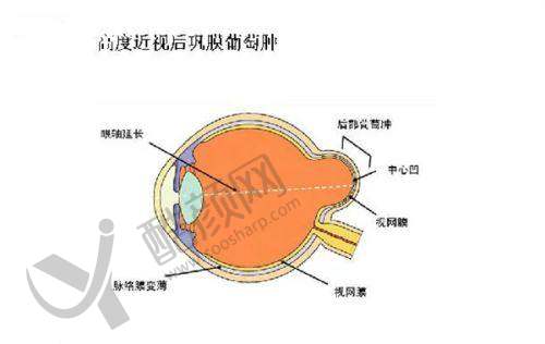 太原大眼熊猫眼科医院贵吗？价格亲民方案多，高品质服务助力清晰视界