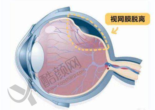 北京同仁医院眼科挂号难怎么办？多渠道攻略+明星医生出诊表助你轻松搞定