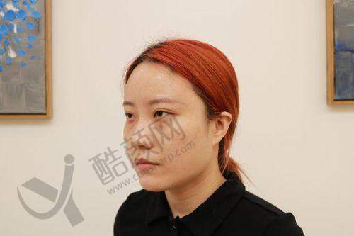 秦皇岛纪辉技术实力：经典技术打造理想美眼