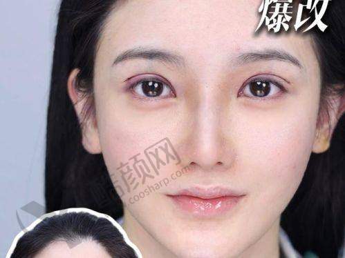 秦皇岛纪辉：正规靠谱的医美机构