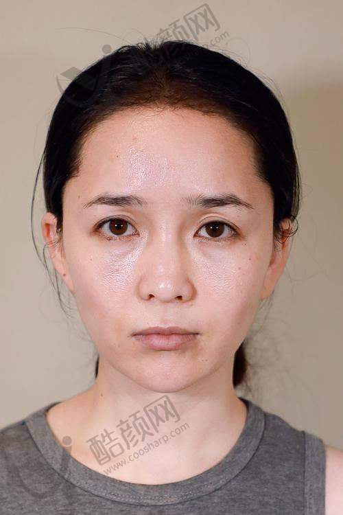 五、南京溯颜医疗美容诊所怎么预约: