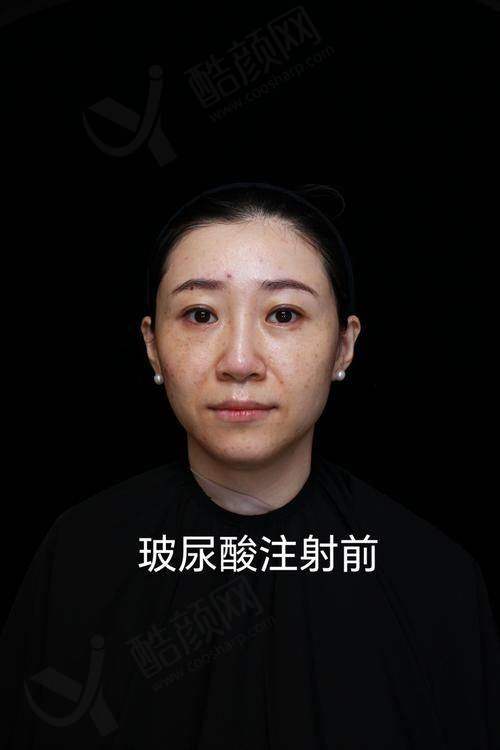 七、南京溯颜医疗美容诊所真实的患者评价如下: