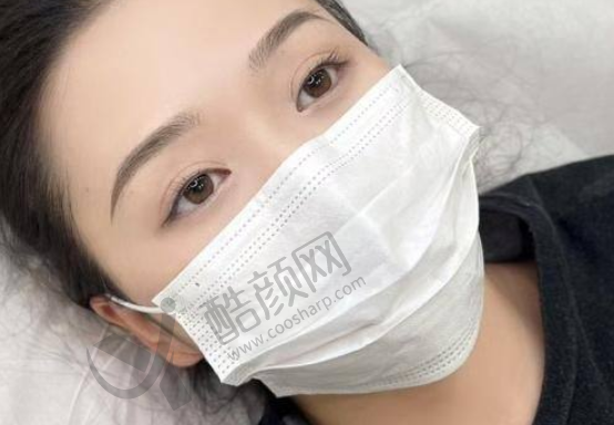 大连爱德丽格刘志刚双眼皮修复的价格与口碑