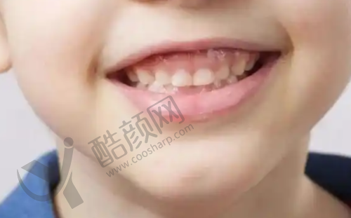 杭州图德口腔·浙江颞下颌关节口腔医院周茂强技术特点