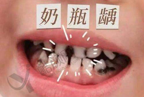 东莞同进口腔门诊部种植牙收费情况