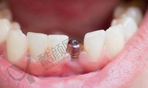 鞍山美年口腔：连锁品牌的优势