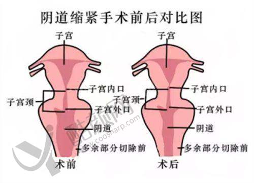 一、上海百汇医疗美容医院怎么样？