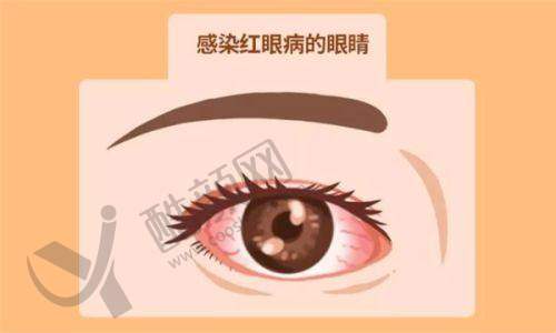 七、赣州启明星眼科医院真实的患者评价如下：