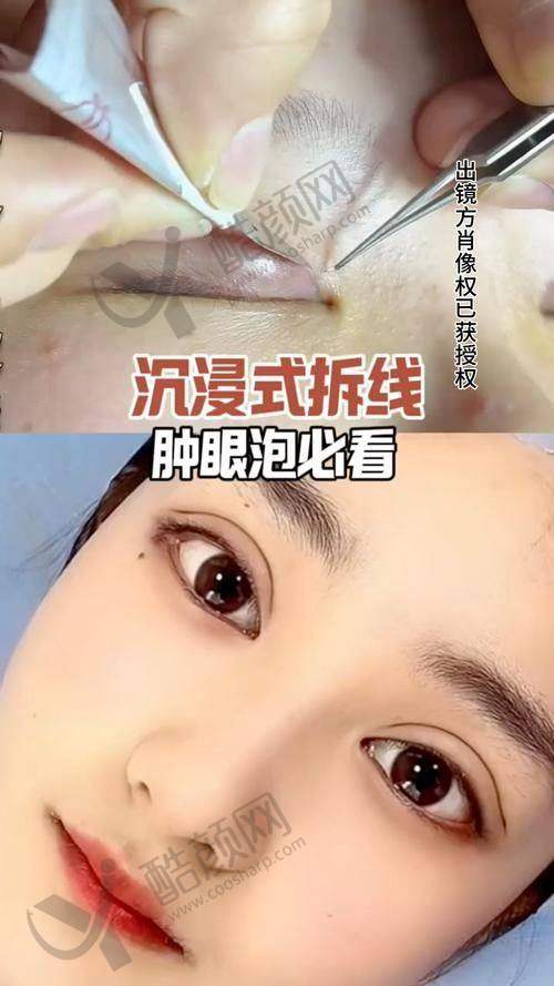 潘贰医生个人资质