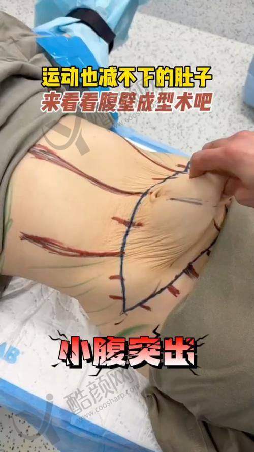 成都现代李献和医生简介