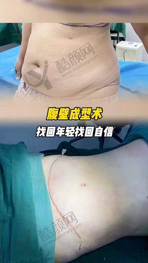 成都现代李献和医生擅长项目怎么样