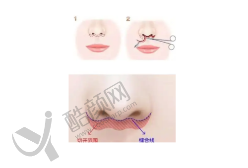 四、深圳大学总医院整形科基本信息: