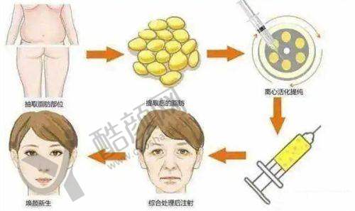 七、深圳大学总医院整形科真实的患者评价如下: