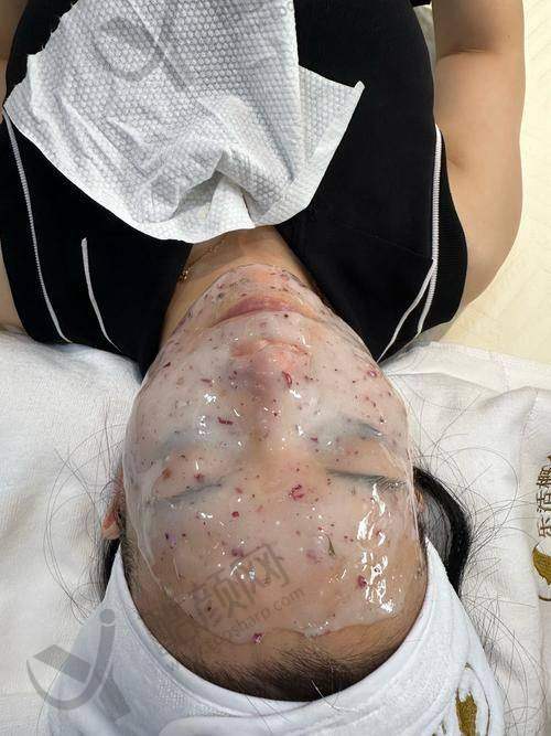 昆明昆大疤痕医院刘志超医生介绍