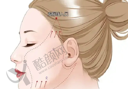 广州海峡医疗美容门诊:高端美容的优选