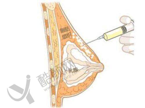 五、成都致臻爱医疗美容门诊部怎么预约：