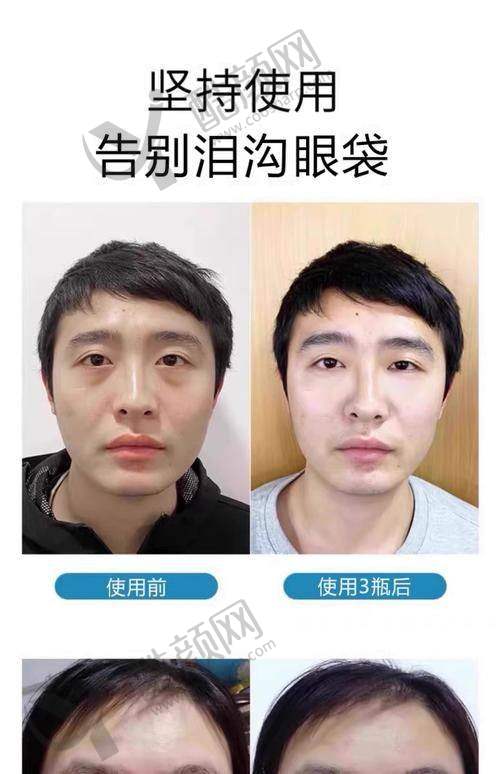 一、杭州健丽（去眼袋）医疗美容诊所怎么样？