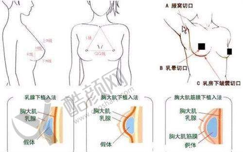 五、济宁曲阜铭城（医联美）整形怎么预约：