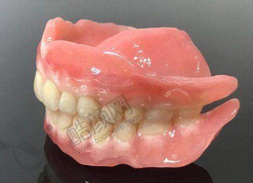 咸阳诺贝尔口腔种植牙优势突出