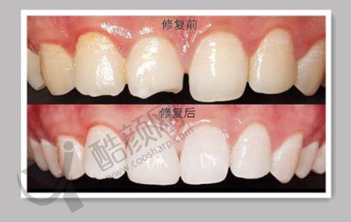 七、西安小白兔口腔医院真实的患者评价如下：