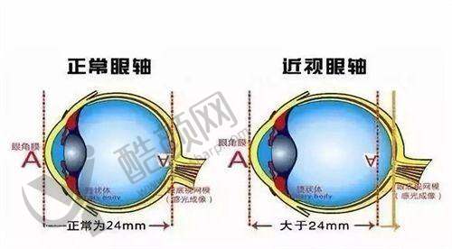 赣州普瑞眼科医院医生操刀优选Smart激光手术，价格10800元起，连锁品质值得信赖 