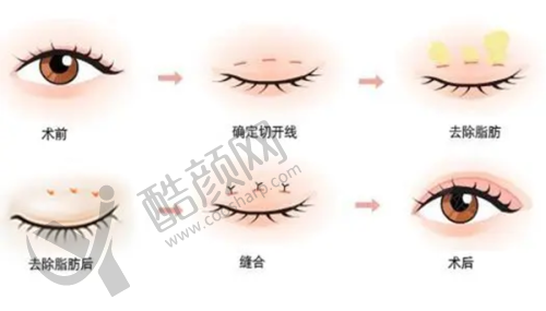邯郸星璨医疗：性价比高，学生党优选