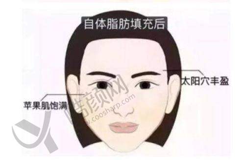 邯郸华景医院美杜莎眼综合：专精眼整形，肿眼泡克星