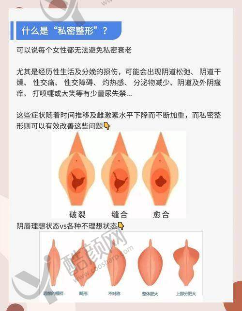 李峰永医生做私密整形怎么样？