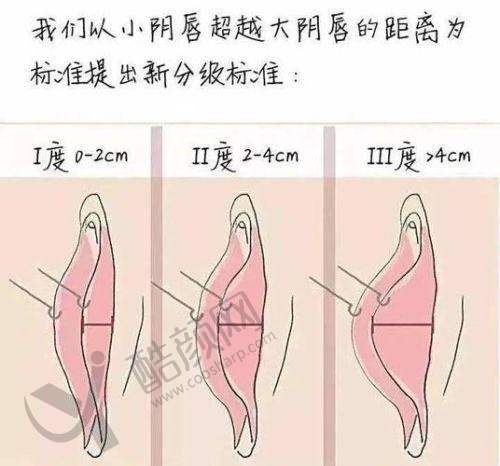 李峰永医生简介