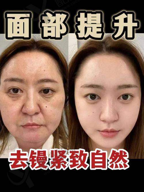 北京加减美范惟医生做擅长项目怎么样？