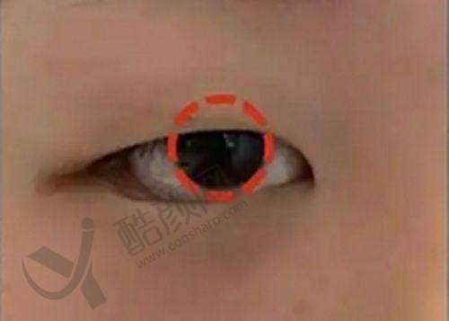 云南吴氏嘉美整形医院的口碑评价
