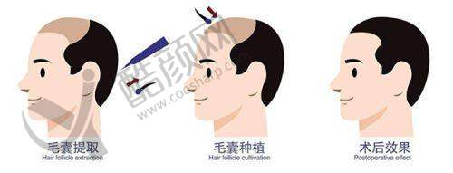 南宁亚太曾开达医生的真实的患者评价如下
