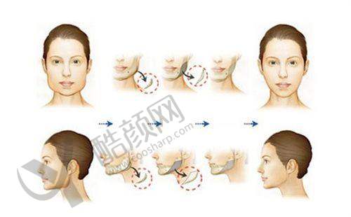 一、江苏淮安童颜焕美医疗门诊部怎么样？